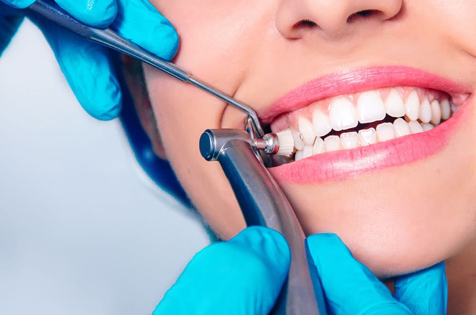 Teeth Cleaning & Scaling at Supreme Multi-Speciality Dental Centre